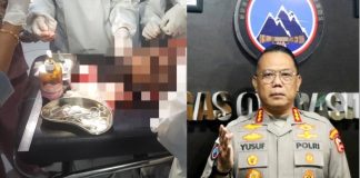 Ujang Supriyatna yang menjadi korban pembacokan saat mendapat perwatan medis di RSUD Dekai (kiri) Kasatgas Humas Operasi Damai Cartenz-2025, Kombes Pol. Yusuf Sutejo, S.I.K. (kanan)