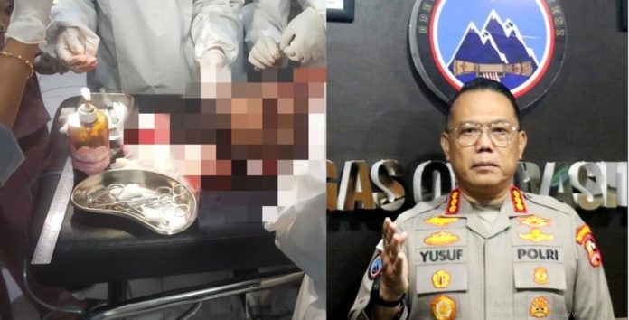 Ujang Supriyatna yang menjadi korban pembacokan saat mendapat perwatan medis di RSUD Dekai (kiri) Kasatgas Humas Operasi Damai Cartenz-2025, Kombes Pol. Yusuf Sutejo, S.I.K. (kanan)
